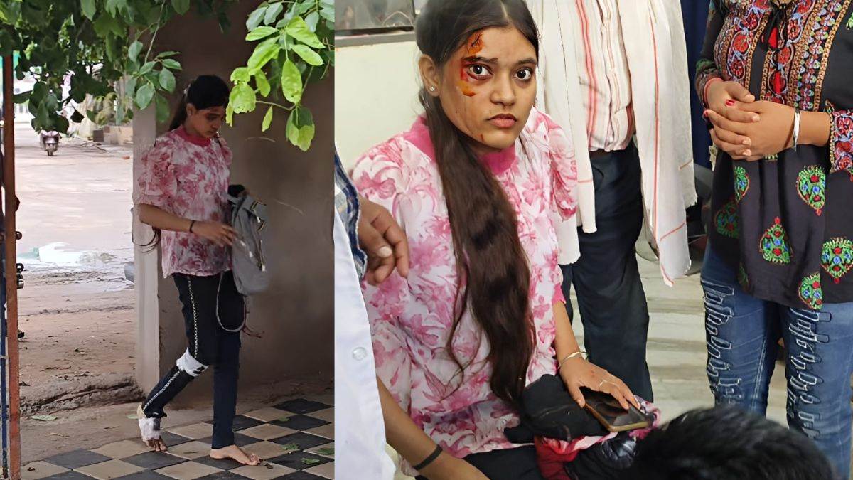 CG Information: छात्रा को बस ने मारी टक्कर, चेहरे व पैर में आए चार टांके, जिद कर देने पहुंची एग्जाम