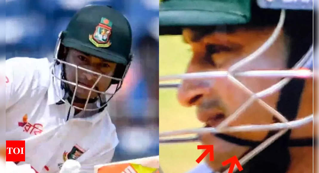 EXPLAINED: Why Bangladesh batsman Shakib Al Hasan is holding a band between his enamel whereas batting | Cricket Information